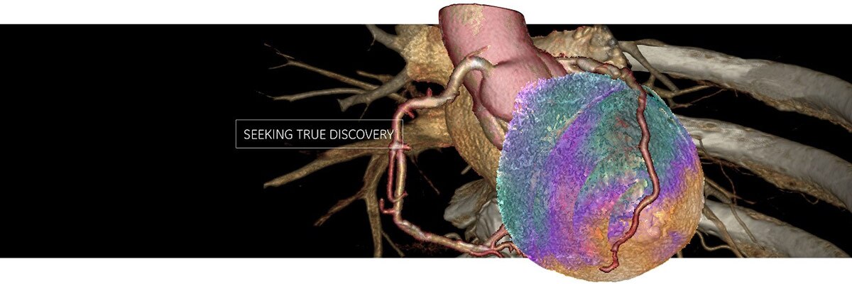 tegories-molecular-imaging-new 2016-gehc molecular imaging web page heart image-edited.jpg