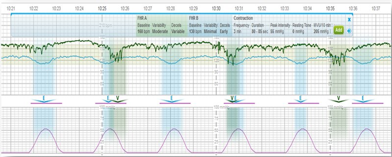 Centricity Perinatal Charting