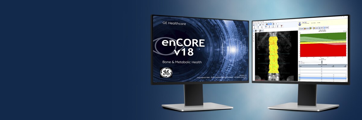 Encore Software Platform Ge Healthcare United States