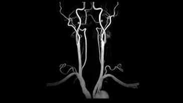 Vascular and Cardiac Imaging
