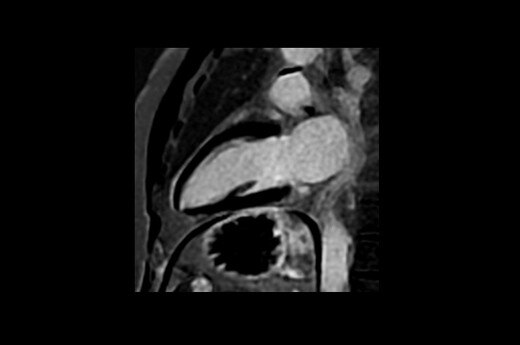 SIGNA™ Artist - 70cm | GE Healthcare