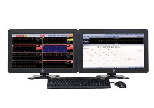 Patient Monitors | Patient Monitoring | GE Healthcare