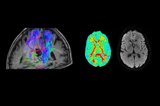 SIGNA™ Artist - 70cm | GE Healthcare