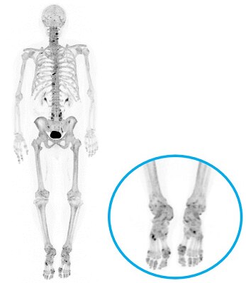 product-product-categories-molecular-imaging-discovery mi -new-test.png