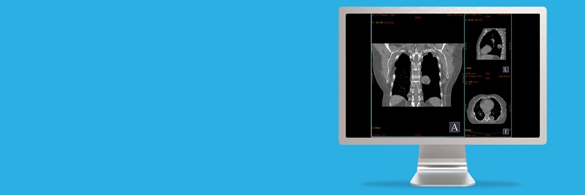 Advantage 4d Ge Healthcare
