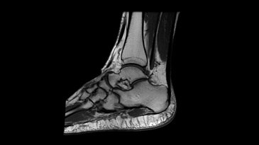 Spine and MSK Imaging