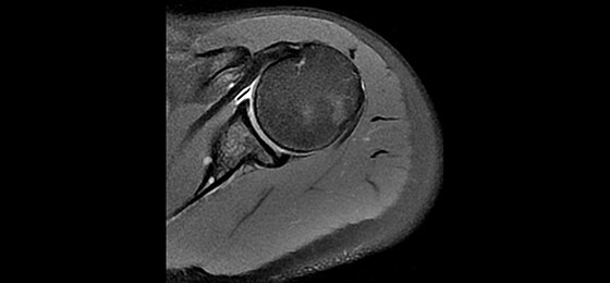 PD PROPELLER Fat Sat Axial