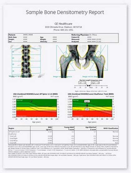 DXA Report