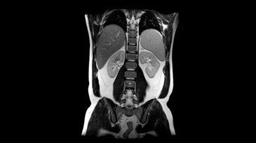 Breast and Body Imaging