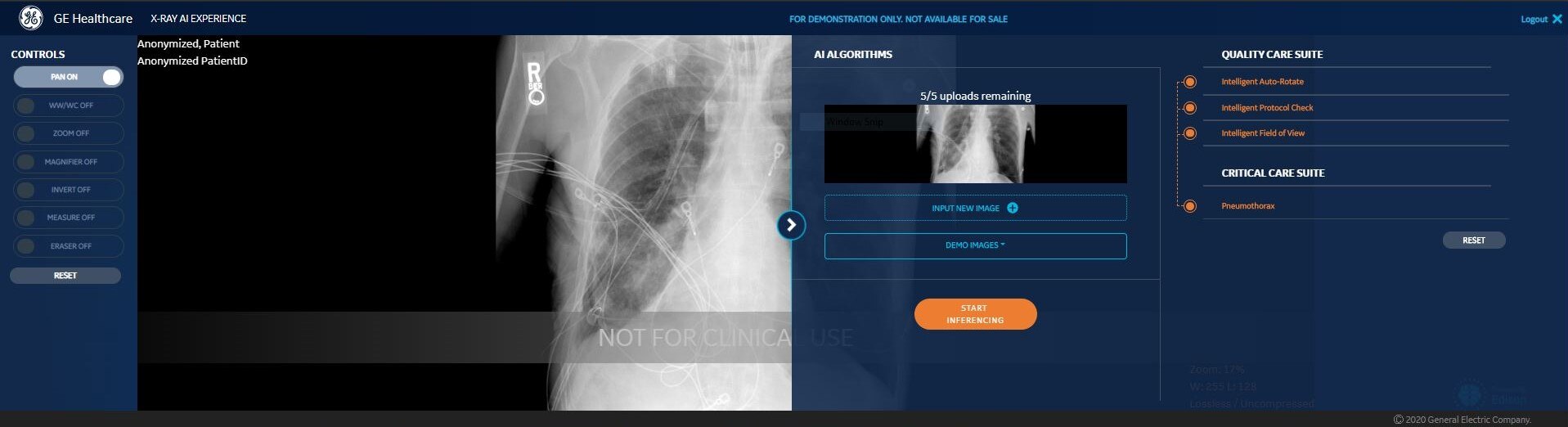 Critical Care Suite On Mobile And Fixed X Ray Systems Ge Healthcare Ge Healthcare United States