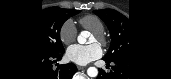 Deep Learning Image Reconstruction