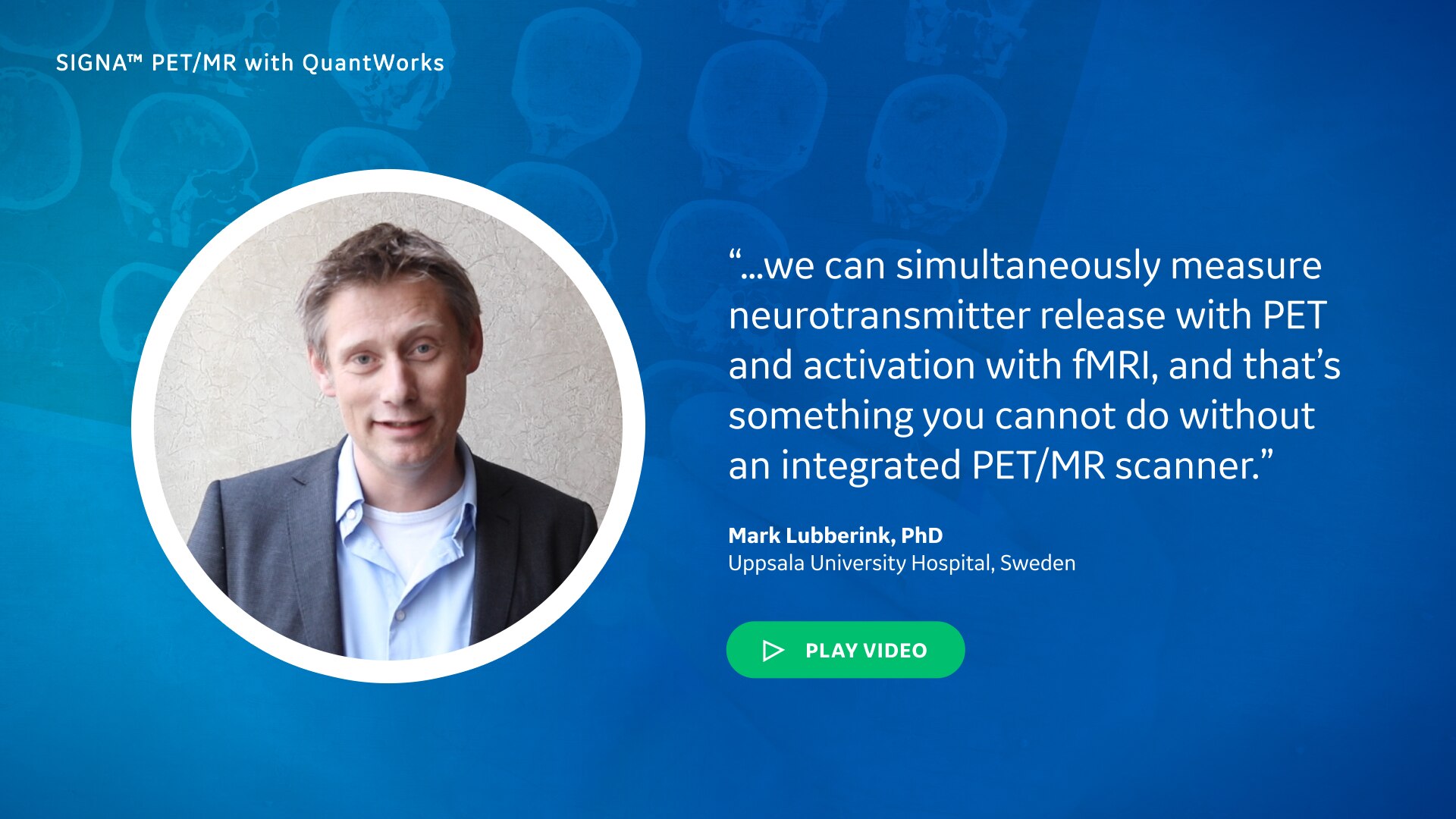 What are the key benefits that PET/MR brings to research initiatives?