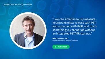 What are the key benefits that PET/MR brings to research initiatives?