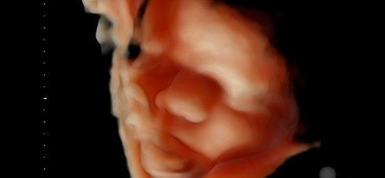 Fetal face with HDlive