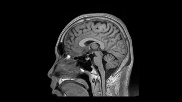 Neuro Imaging