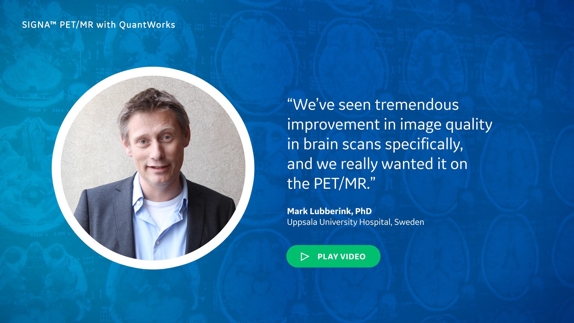 What new PET/MR advances from GE excite you?