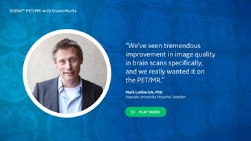 What new PET/MR advances from GE excite you?