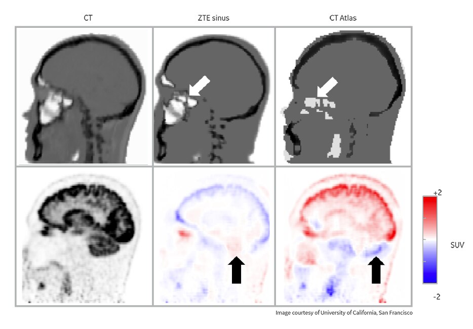 product-product-categories-magnetic-resonance-imaging-signa petmr-ZTE MR.png