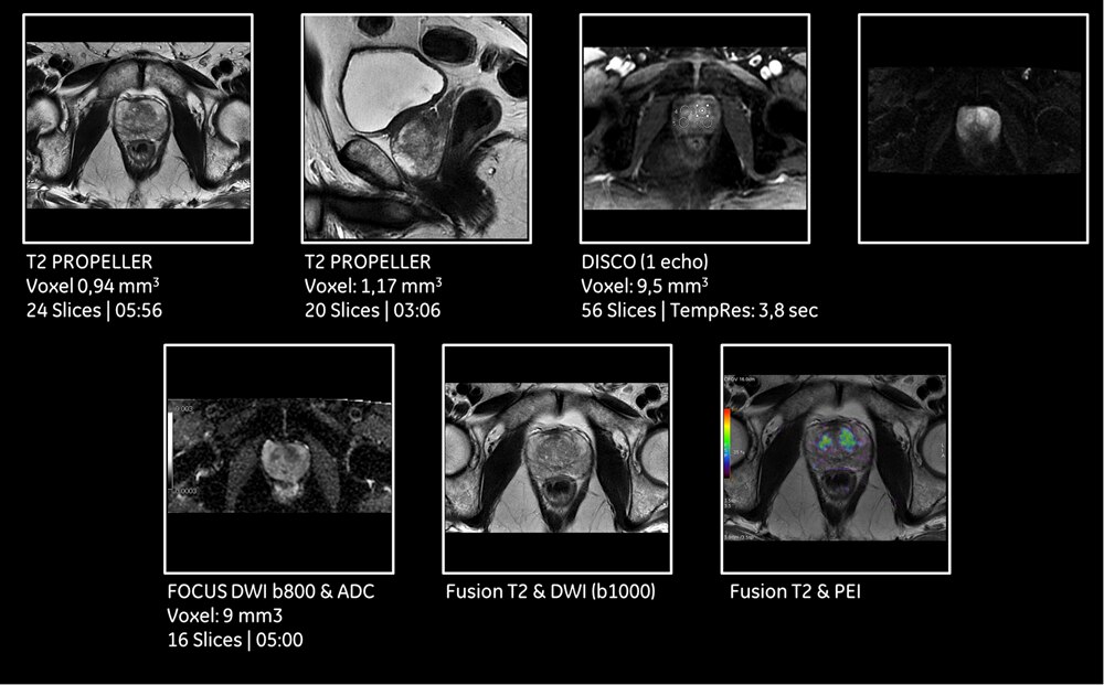 Signa Pioneer Ge Healthcare