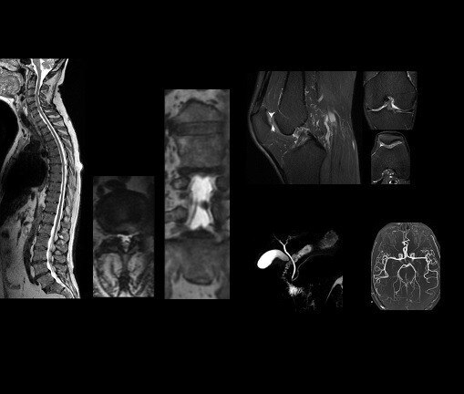 HyperSense Knee Cube .4 x .4 x 4mm
