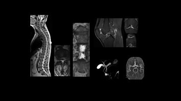 HyperSense Knee Cube .4 x .4 x 4mm