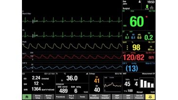 CARESCAPE B450 | Patient Monitoring | GE Healthcare