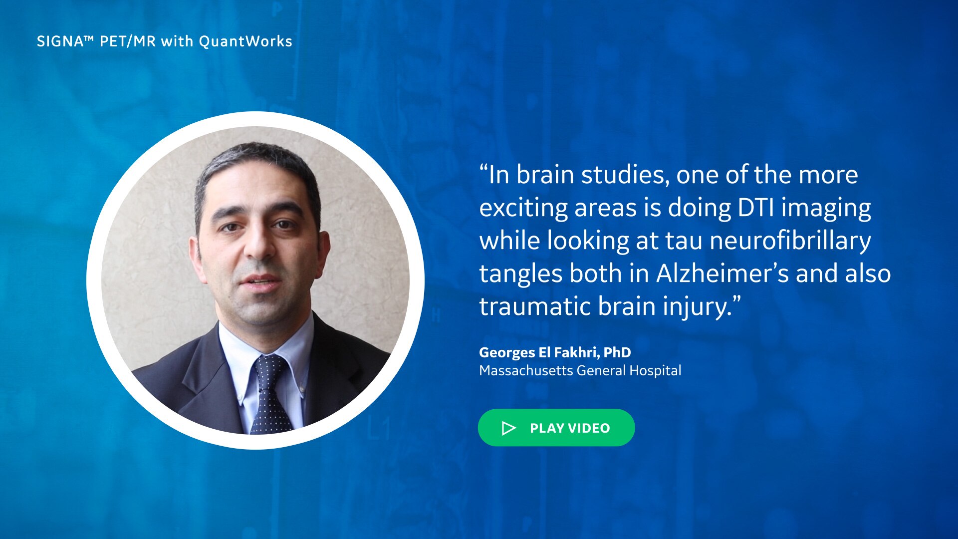 Where do you think PET/MR technology will take you in the next 5 years?