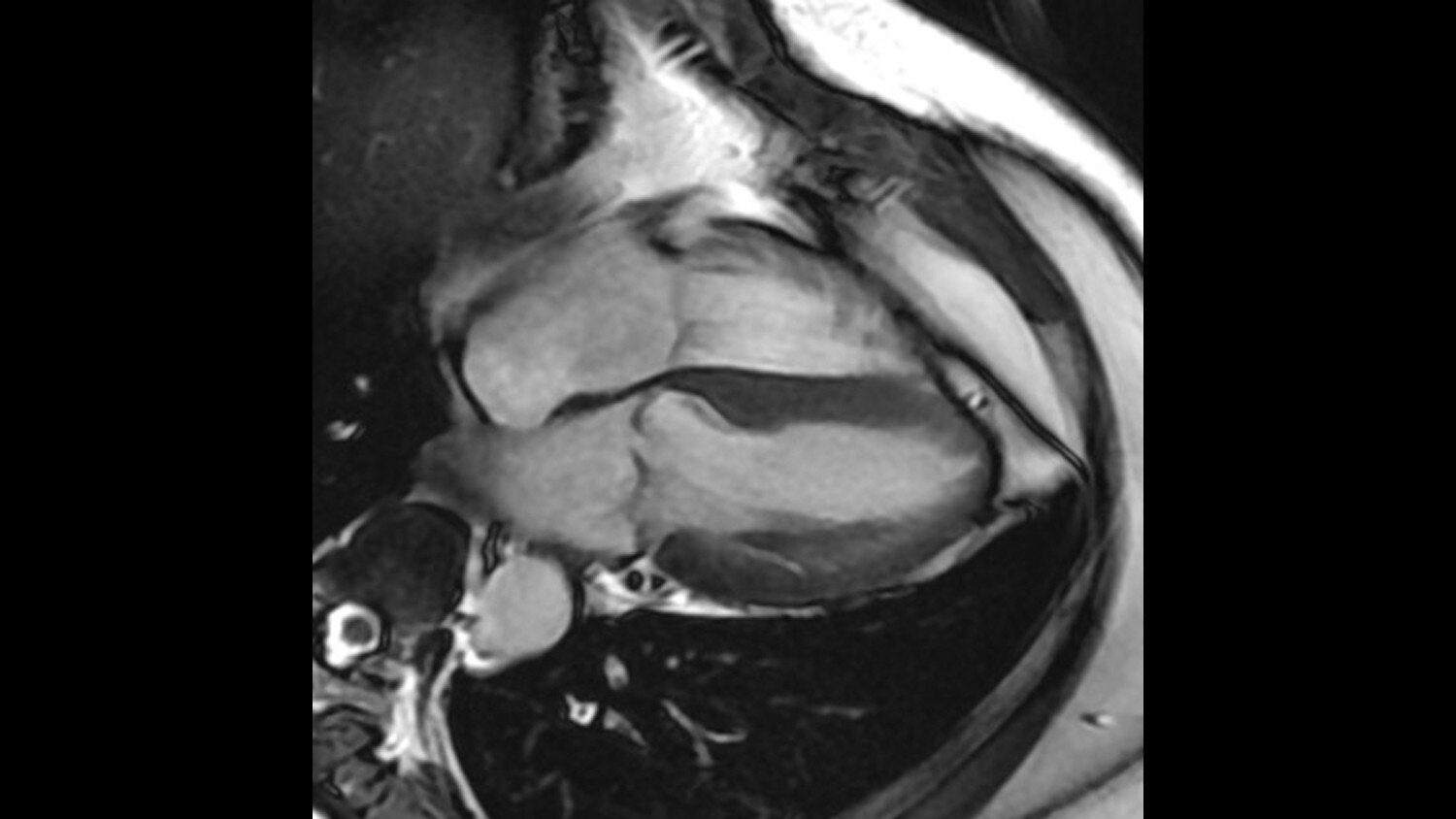 FIESTA Cine Long Axis