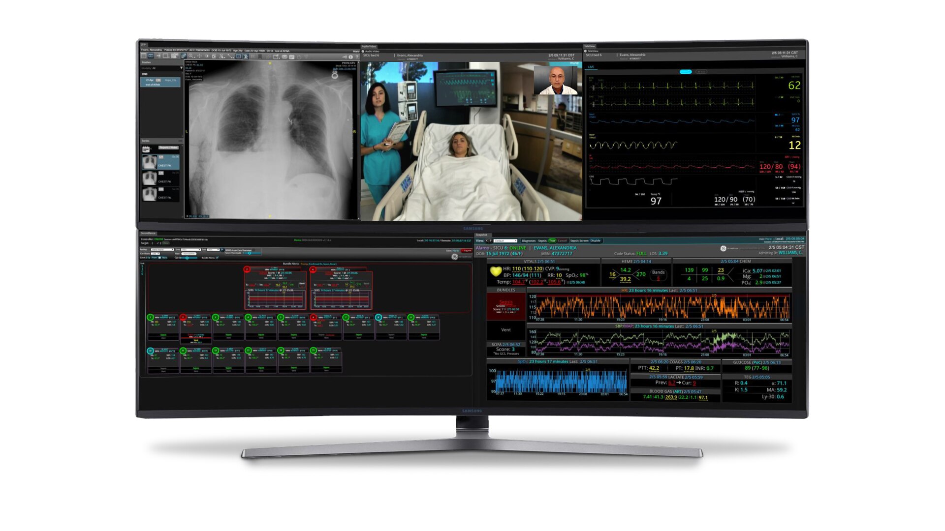 Computer monitor with 5 modules of the Mural Virtual Care Solution A/V xray waveform