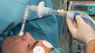 Sampling Lines in Anesthesia Monitoring Details Make a Difference | GE ...