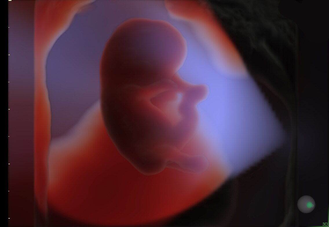 HDlive Studio on a 10-week fetus