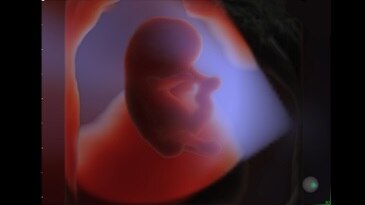 HDlive Studio on a 10-week fetus