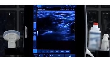 Ge Venue 50 User Manual Pdf Ge Venue 50 User Manual Pdf