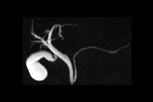 SIGNA™ Artist - 70cm | GE Healthcare