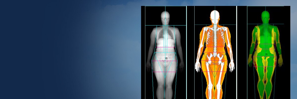 Body Composition Scan - Center for Reproductive Medicine and
