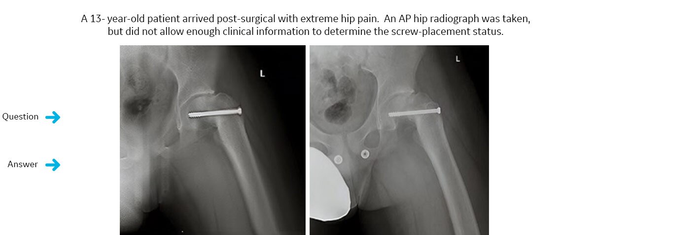 Discovery-XR656-Plus-galeryimage-00