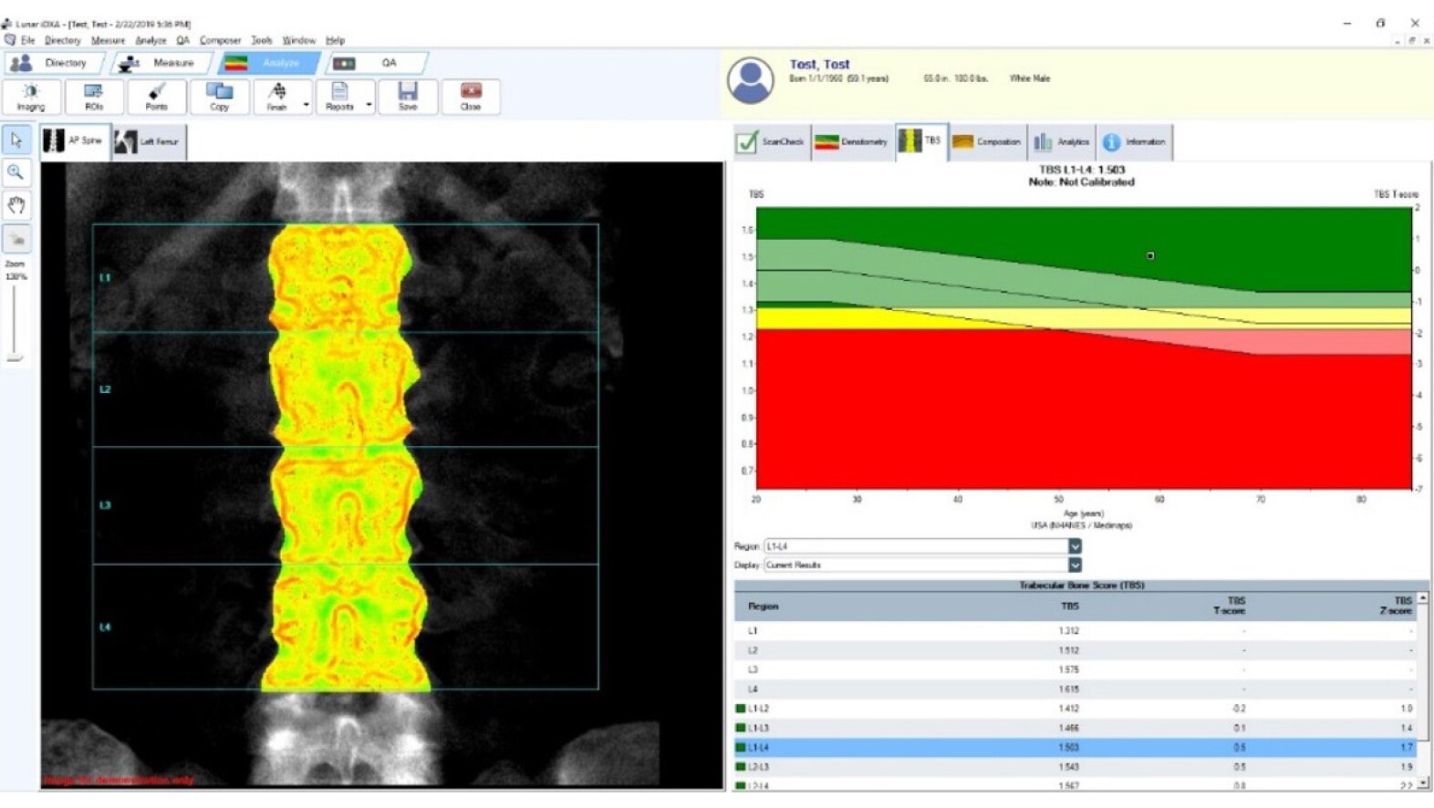 Bone and Metabolic Health Applications | GE HealthCare Bone and Metabolic Health Applications | GE HealthCare