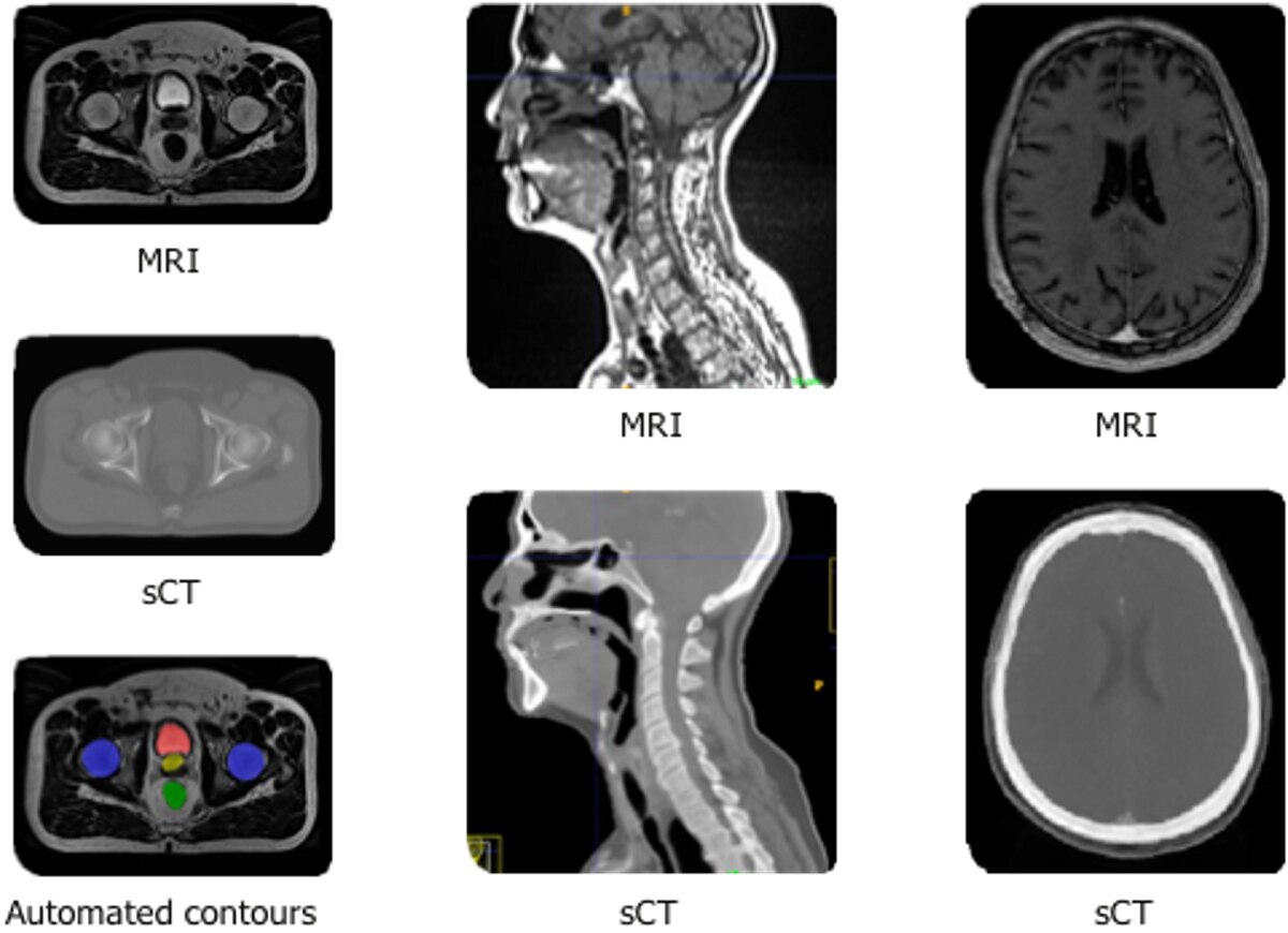 Enabling Radiation Oncology Treatment Planning with Advanced Imaging