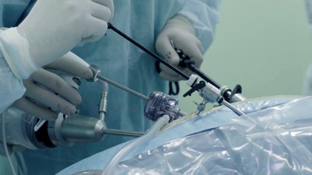 Two clinicians performing laparoscopic surgery on a patient