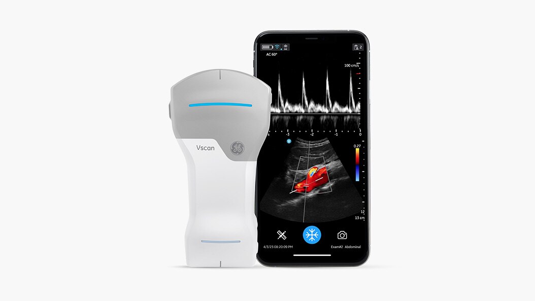 GE Healthcare Vscan ハンディスキャナー GE Healthcare Unveils Vscan Air Wireless Handheld Ultrasound