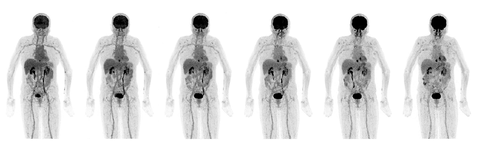 Discovery MI Gen 2 | GE Healthcare (United States)