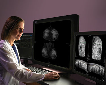 Female clinician reviewing automated breast ultrasound images on a monitor