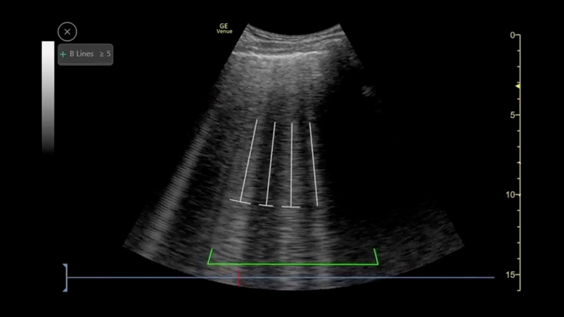 Auto-B-lines-C1-5-RS-desktop