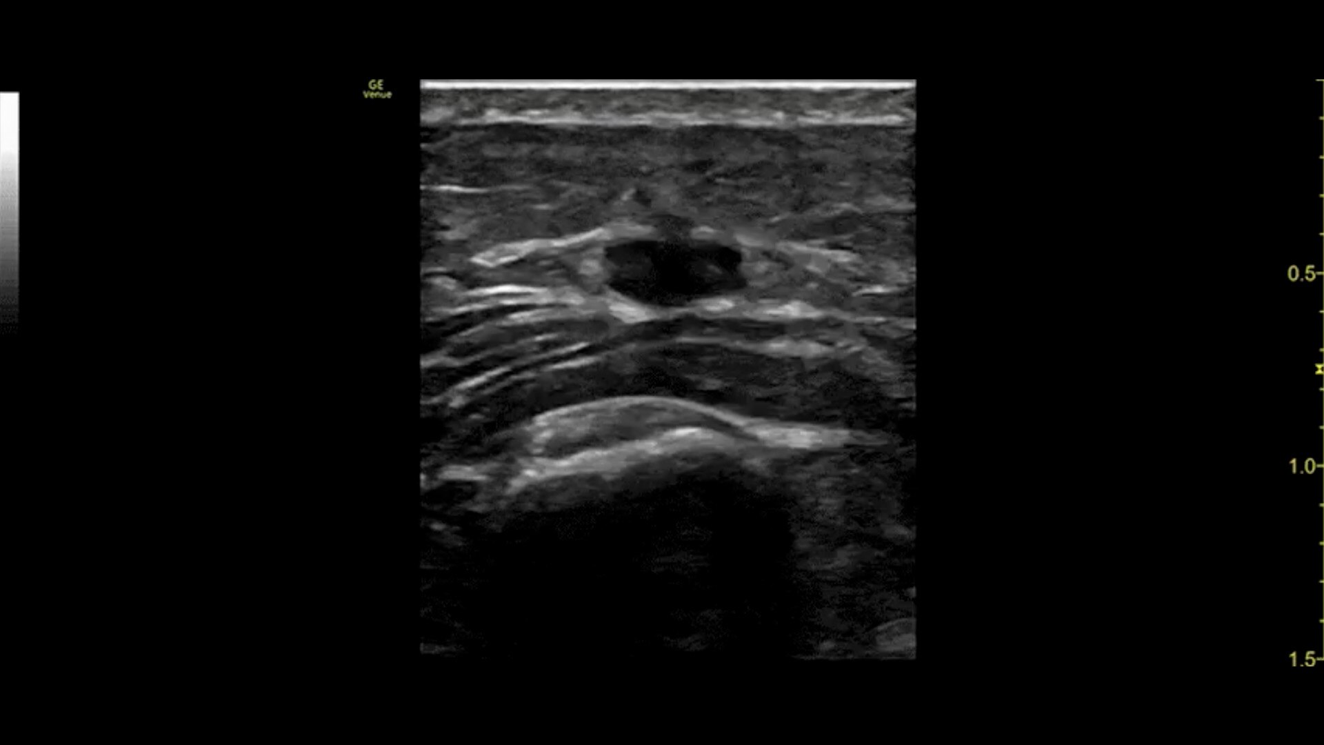 Vascular-Access-L10-22-desktop