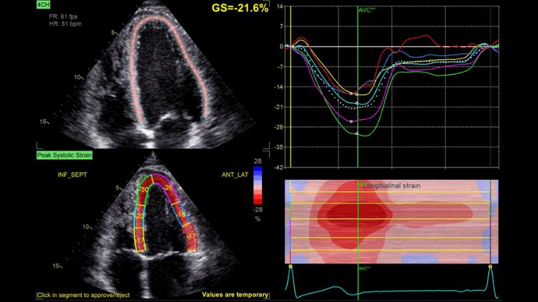 Vivid™ E Series Applications | GE HealthCare (United States)