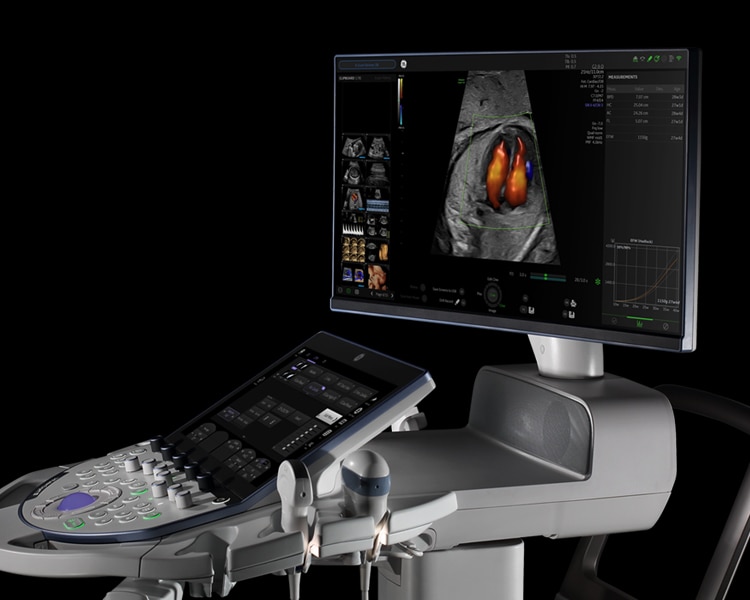 Voluson™ Expert 18 | GE HealthCare (United States)