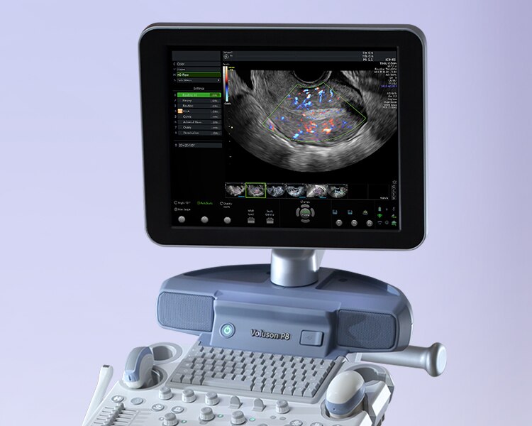 Voluson P8 | GE HealthCare (Japan)