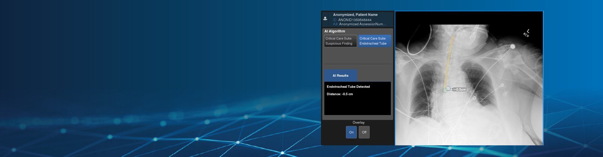 Critical Care Suite 2.0* powered by Edison | GE Healthcare (United States)