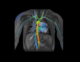 Viosworks Imaging Application for SIGNA™ | GE HealthCare
