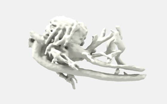 3D Printing of Voluson technology